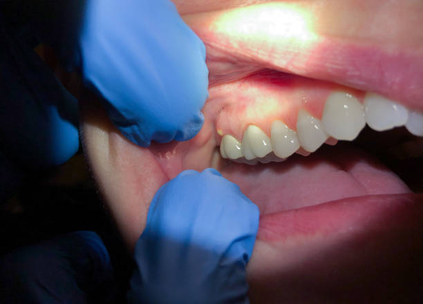 Best After-Hours Emergency Dentist in Lilburn, GA