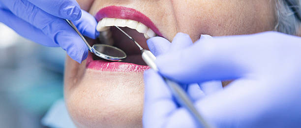 Best Emergency Wisdom Teeth Removal in Lilburn, GA